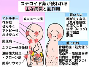 注射１本で花粉症が治りますよ 古河市で筋肉を軟らかくして痛みを改善する口コミでおすすめの治療院 総和治療院